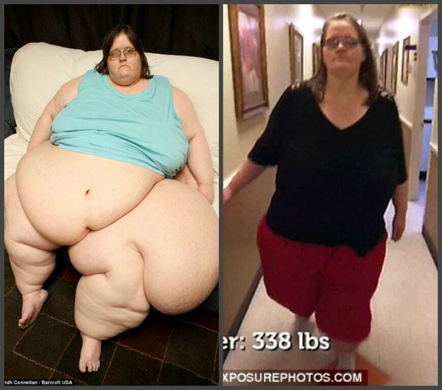 Найповніша жінка в світі схудла на 200 кг