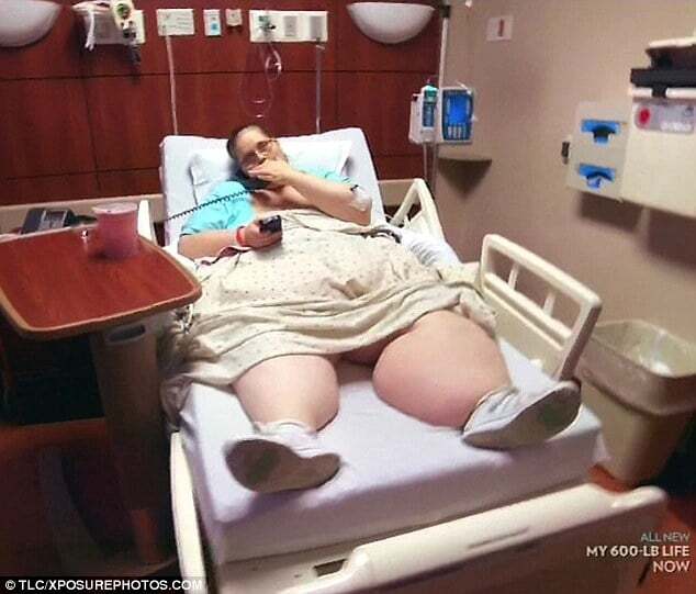 Самая полная женщина в мире похудела на 200 кг: поразительные фото