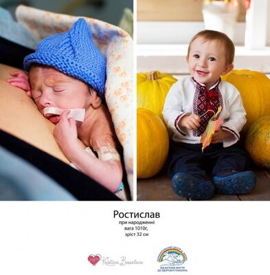 Чудо рождения: фотопроект недоношенных детей, который завораживает