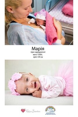 Чудо рождения: фотопроект недоношенных детей, который завораживает