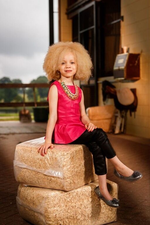 Афроамериканка-альбинос стала звездой модного мира: поразительные фото