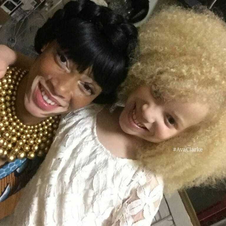 Афроамериканка-альбинос стала звездой модного мира: поразительные фото