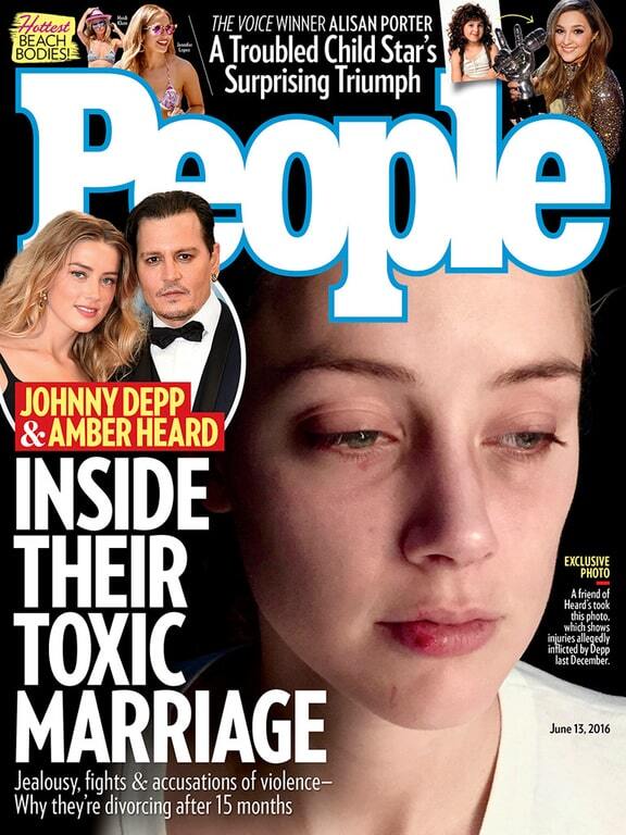 "Я испугалась за свою жизнь": жена Джонни Деппа обнародовала новые фото побоев