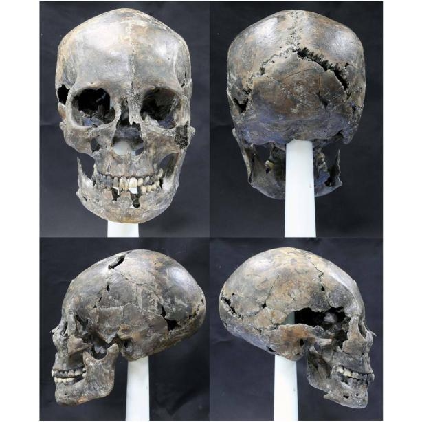 Древняя женщина: в Южной Корее обнаружен череп необычной формы. Фото