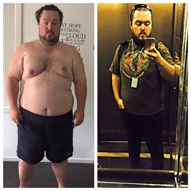 Невероятная сила духа: страдающие от ожирения супруги из Австралии на двоих сбросили 172 кг