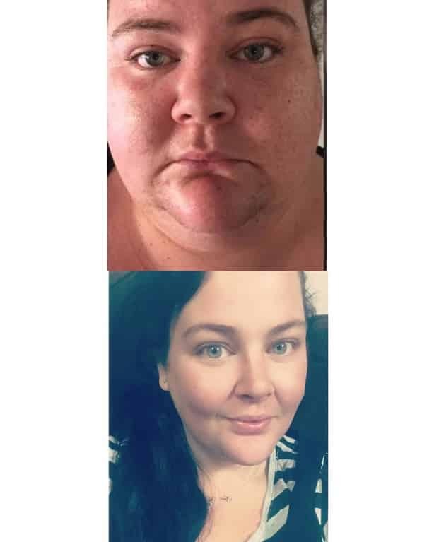 Невероятная сила духа: страдающие от ожирения супруги из Австралии на двоих сбросили 172 кг