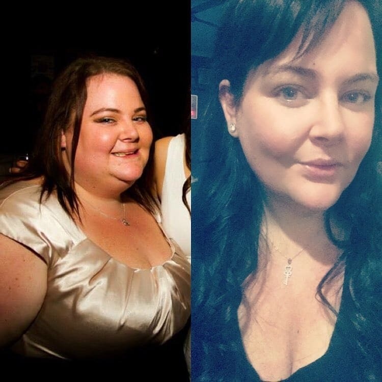 Невероятная сила духа: страдающие от ожирения супруги из Австралии на двоих сбросили 172 кг