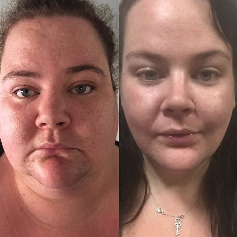 Невероятная сила духа: страдающие от ожирения супруги из Австралии на двоих сбросили 172 кг