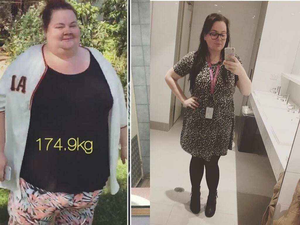 Невероятная сила духа: страдающие от ожирения супруги из Австралии на двоих сбросили 172 кг