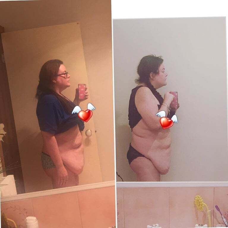 Невероятная сила духа: страдающие от ожирения супруги из Австралии на двоих сбросили 172 кг
