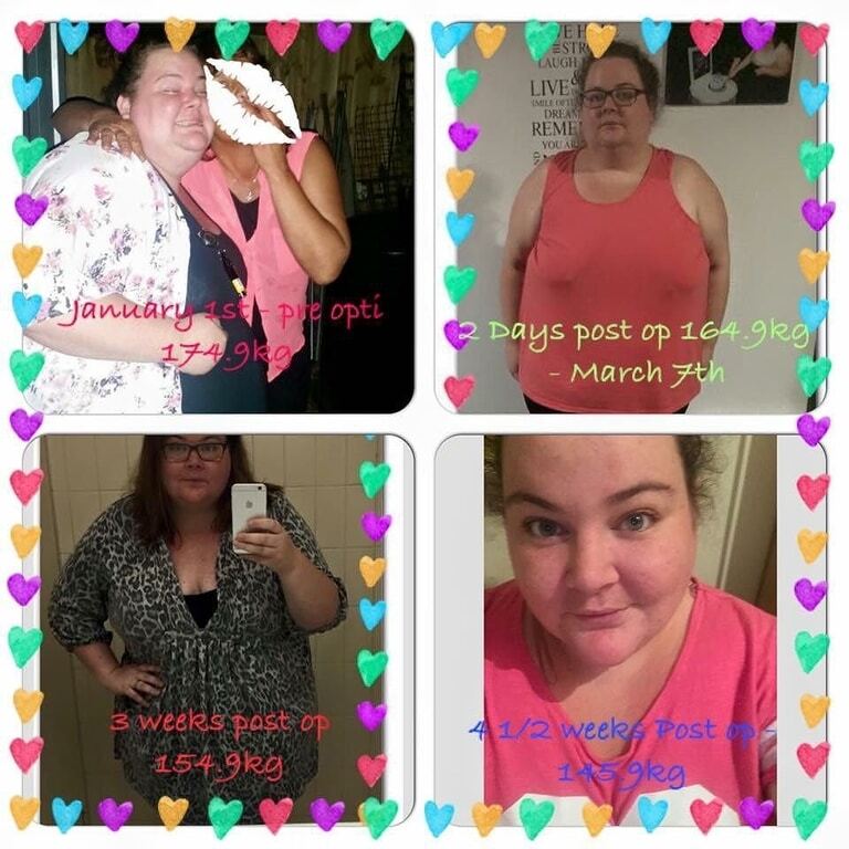 Невероятная сила духа: страдающие от ожирения супруги из Австралии на двоих сбросили 172 кг