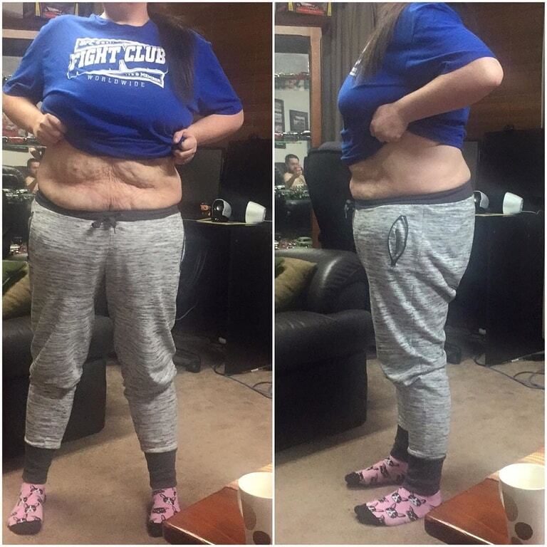 Невероятная сила духа: страдающие от ожирения супруги из Австралии на двоих сбросили 172 кг