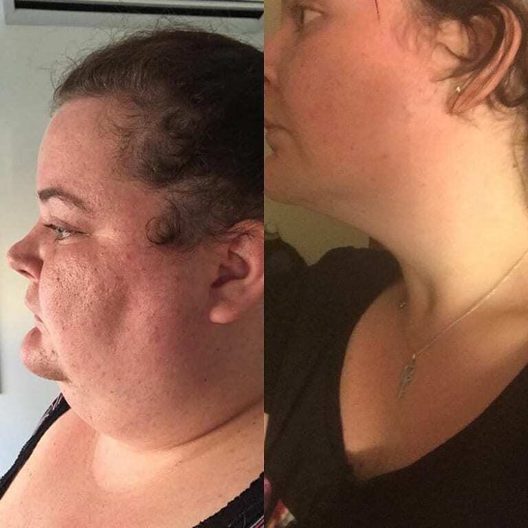 Невероятная сила духа: страдающие от ожирения супруги из Австралии на двоих сбросили 172 кг