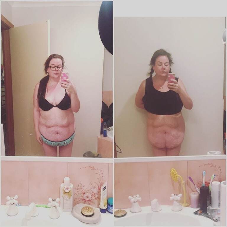 Невероятная сила духа: страдающие от ожирения супруги из Австралии на двоих сбросили 172 кг