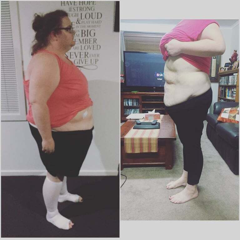 Невероятная сила духа: страдающие от ожирения супруги из Австралии на двоих сбросили 172 кг