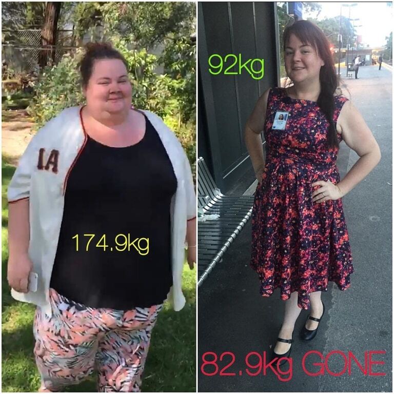 Невероятная сила духа: страдающие от ожирения супруги из Австралии на двоих сбросили 172 кг