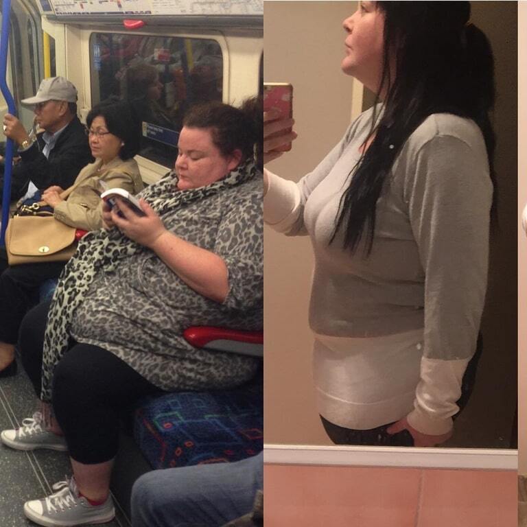 Невероятная сила духа: страдающие от ожирения супруги из Австралии на двоих сбросили 172 кг