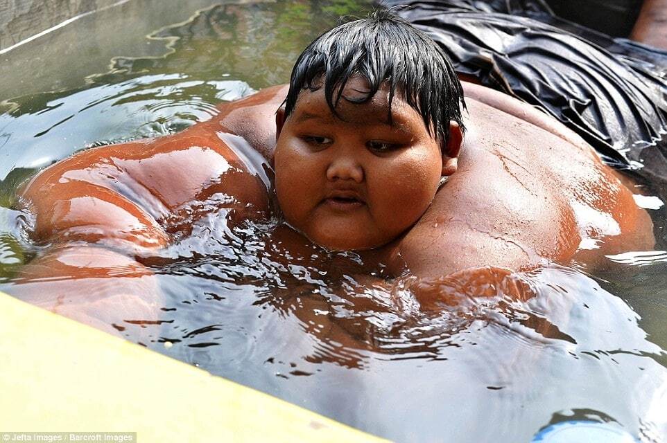 В Индонезии найден самый толстый мальчик в мире: фото 192-килограммового гиганта