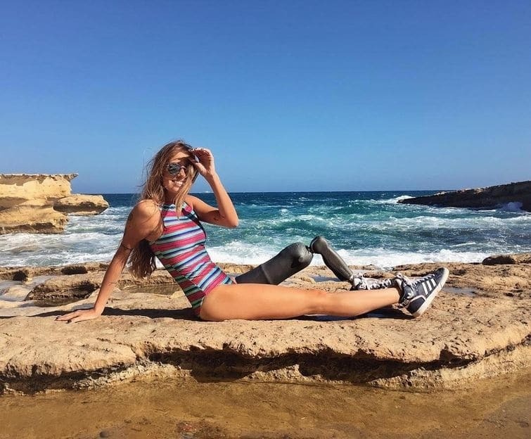 Модель без ноги из Бразилии стала звездой Instagram