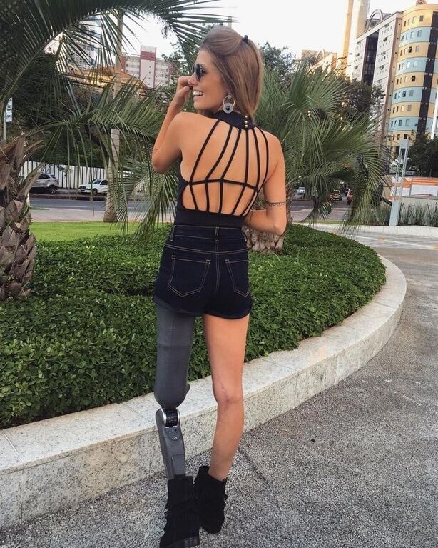 Модель без ноги из Бразилии стала звездой Instagram: оптимистические фото