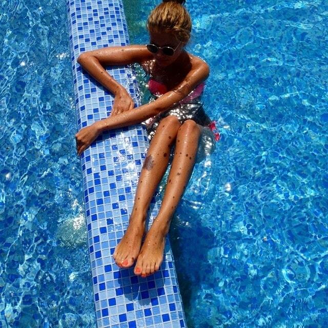 Необычная красота: украинка с тысячью родинок на теле стала звездой сети