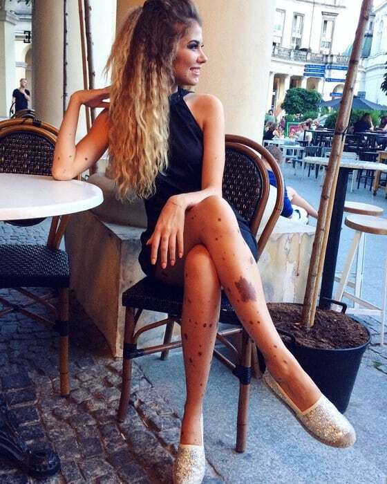 Необычная красота: украинка с тысячью родинок на теле стала звездой сети