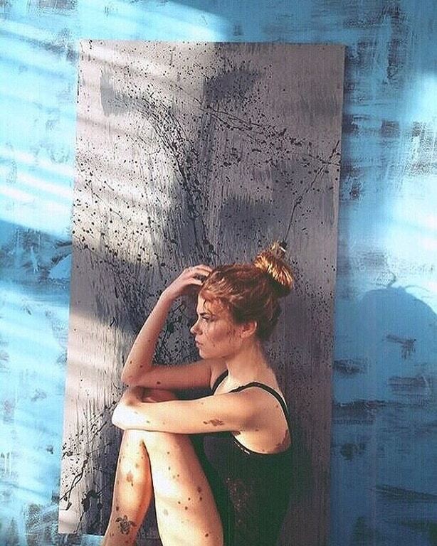 Необычная красота: украинка с тысячью родинок на теле стала звездой сети