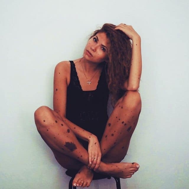 Необычная красота: украинка с тысячью родинок на теле стала звездой сети