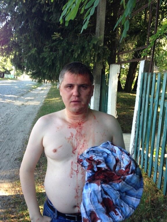 На Черниговщине избили сторонника "русского мира" из КПУ: опубликованы фото и видео