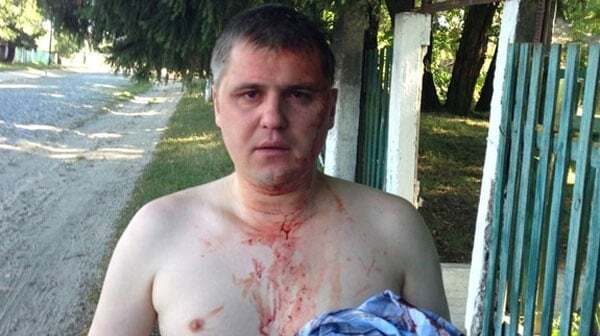 На Черниговщине избили сторонника "русского мира" из КПУ: опубликованы фото и видео