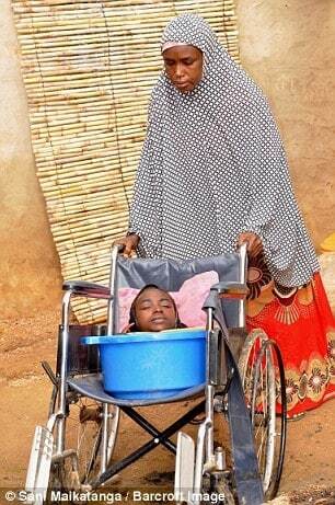 В Нигерии девушка с телом младенца 19 лет живет в тазу. Опубликованы жуткие фото и видео 