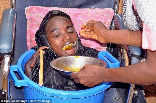 В Нигерии девушка с телом младенца 19 лет живет в тазу. Опубликованы жуткие фото и видео 