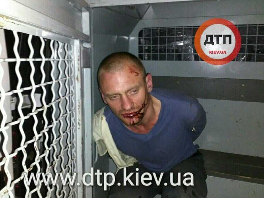 Под Киевом хозяин дома сильно избил ночных грабителей: фотофакт