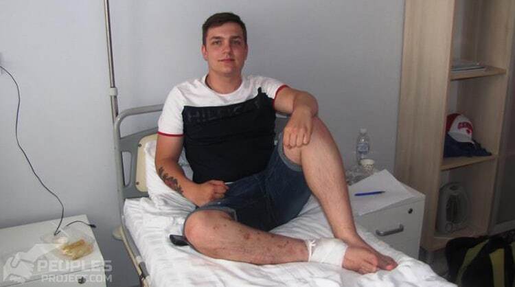 Ранили под Песками: украинские врачи-биотехнологи восстановили ногу 19-летнего добровольца. Опубликованы фото