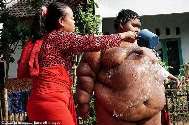 Самый толстый мальчик в мире похудел ради учебы в школе: шокирующие фото