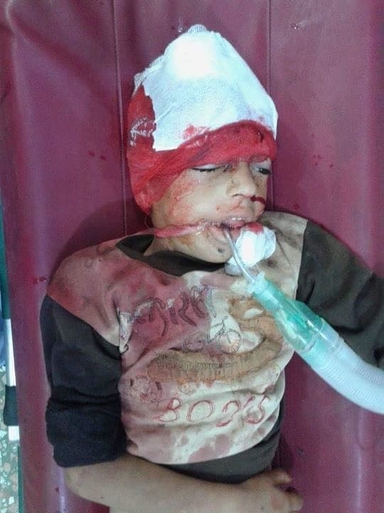 Погибли дети: в Сирии российская авиация разбомбила лагерь беженцев. Опубликованы фото и видео