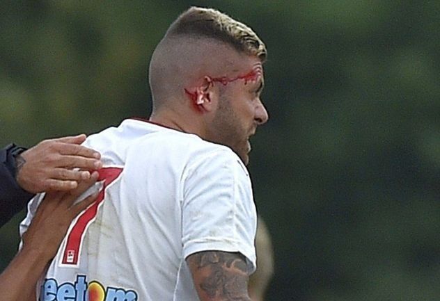 Известному футболисту оторвали ухо в матче за новый клуб: фото не для слабонервных