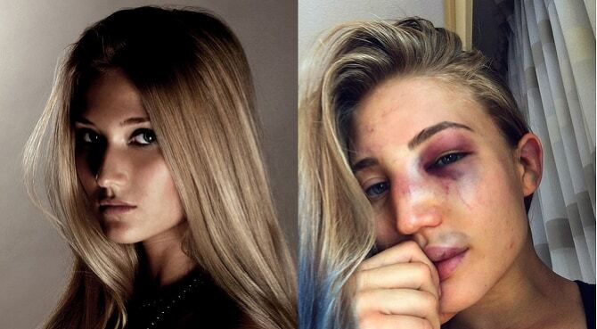 Блогери показали, як виглядають дівчата після боїв у ММА