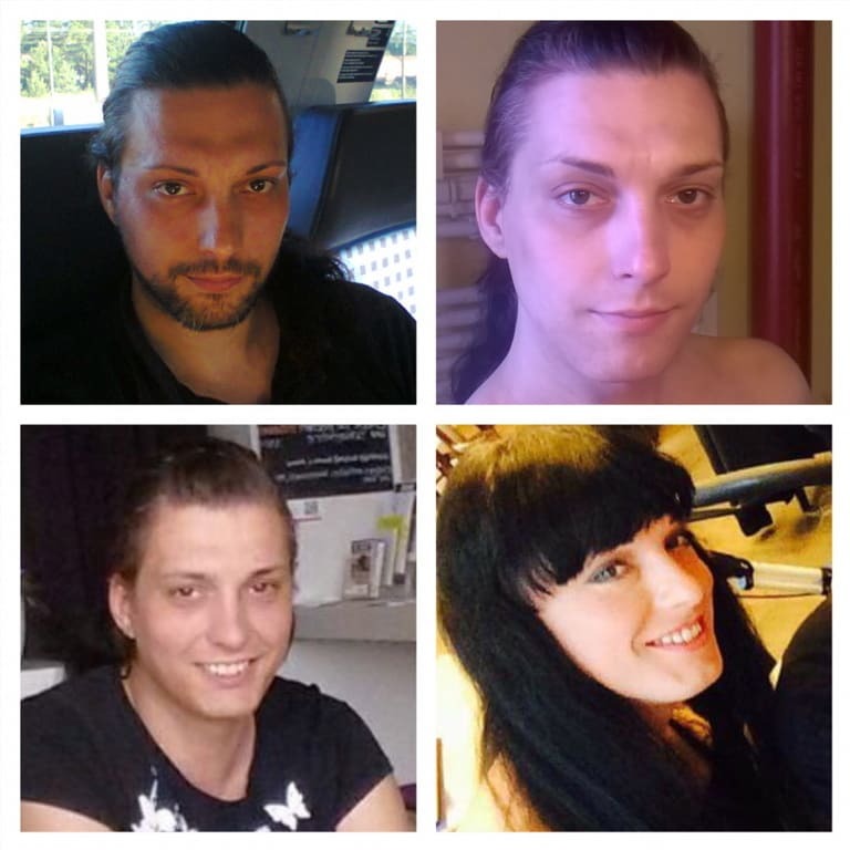 Заложники собственного тела: трансгендеры всего мира поделились фото своих трансформаций