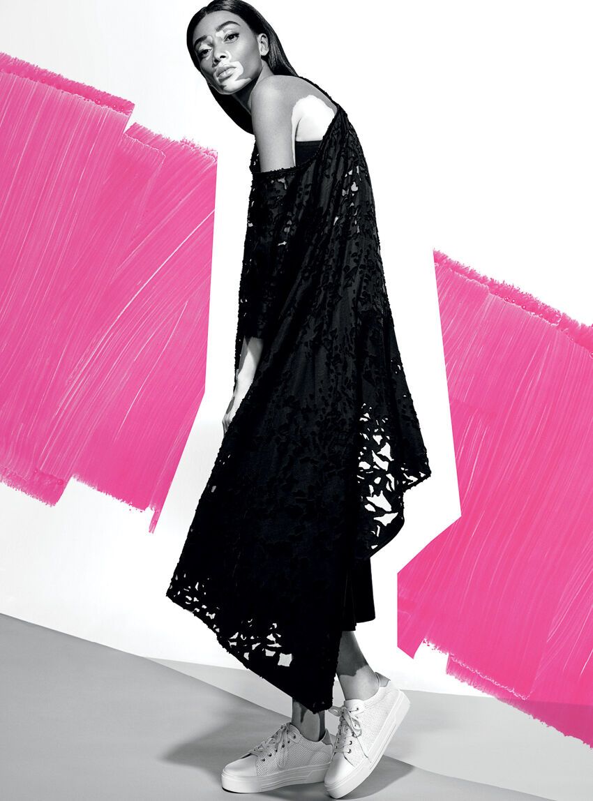 Пятнистая модель Винни Харлоу показала нестандартную красоту в роскошном фотосете для Elle