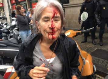 Референдум в Каталонии: полиция применила резиновые пули, сотни пострадавших