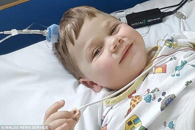Зібрали череп, як головоломку: 5-річному хлопчику провели найнебезпечнішу операцію