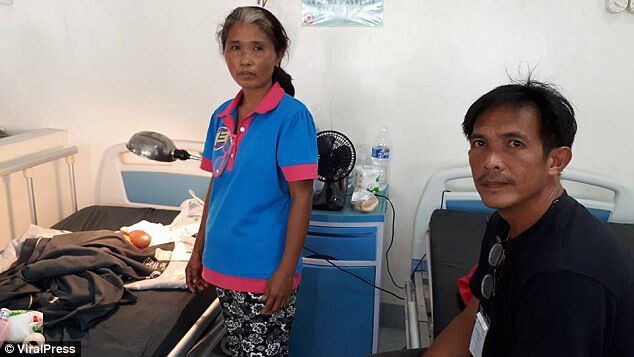 Большой воздушный шар на лице: девочка на Филиппинах родилась с шокирующей патологией