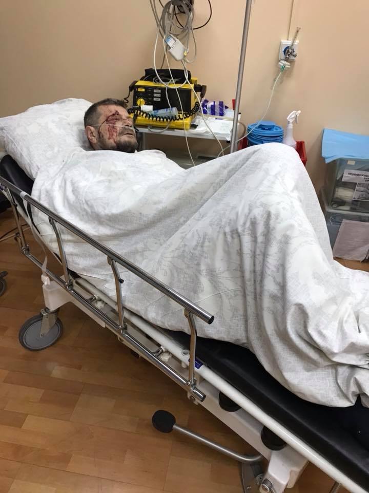 Замах на Мосійчука: з'явилися фото пораненого нардепа