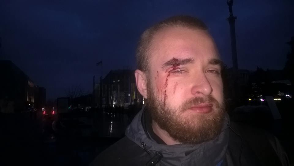 Лицо в крови: появилось фото известного "киборга" после избиения в Киеве