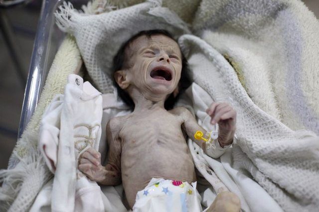 ''Напоминает куклу из фильма ужасов'': сирийский мальчик стал новым символом войны