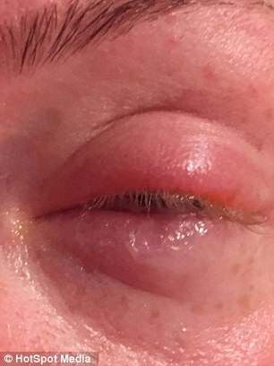 ''Кто-то резал мои глаза бритвой'': девушка почти ослепла из-за праздничного макияжа