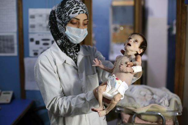''Напоминает куклу из фильма ужасов'': сирийский мальчик стал новым символом войны