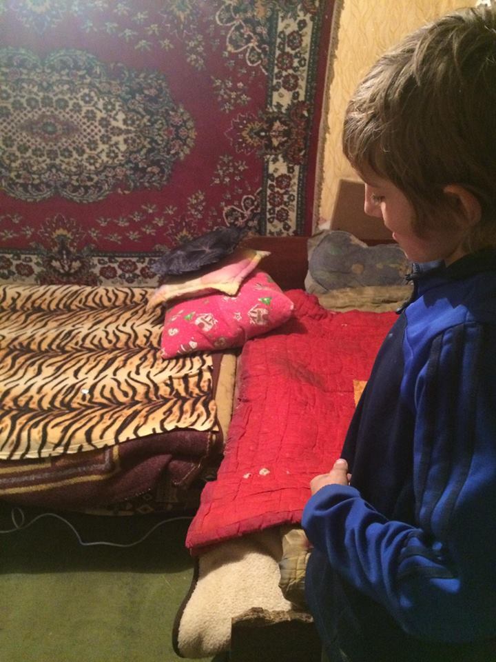 7-летний малыш сам снимал повязки... отдирая их с мясом