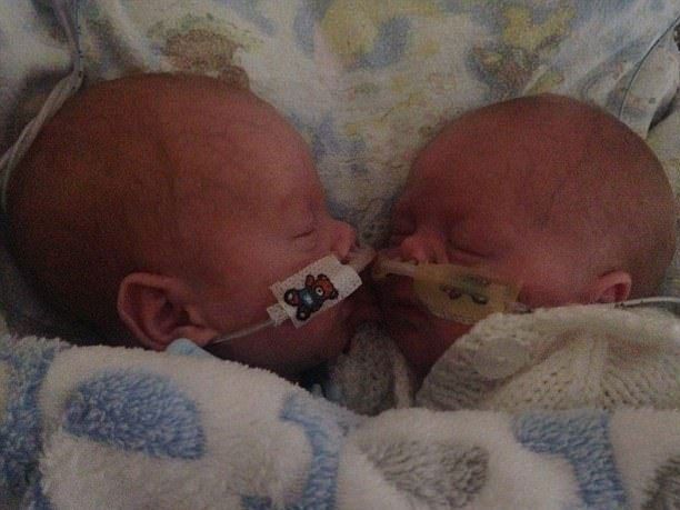 Родившиеся раньше срока близнецы смогли спасти друг друга